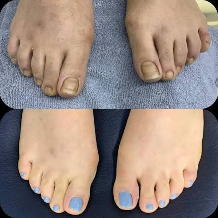 باديكير ومانيكير علاجي